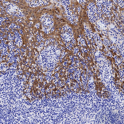 14-3-3 sigma Rabbit Polyclonal Antibody