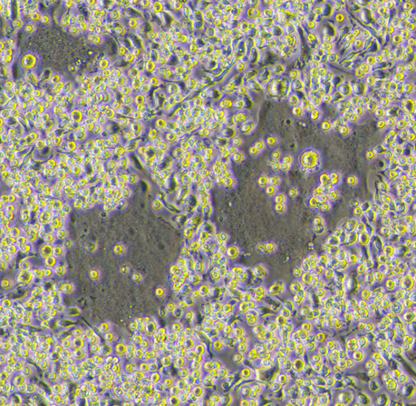 Mouse Bone Marrow-derived Macrophages (BMMs) Osteoclast Differentiation Cytokine Kit