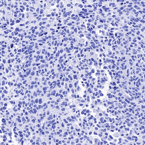 MUC4 Recombinant Rabbit mAb (SDT-841-13)