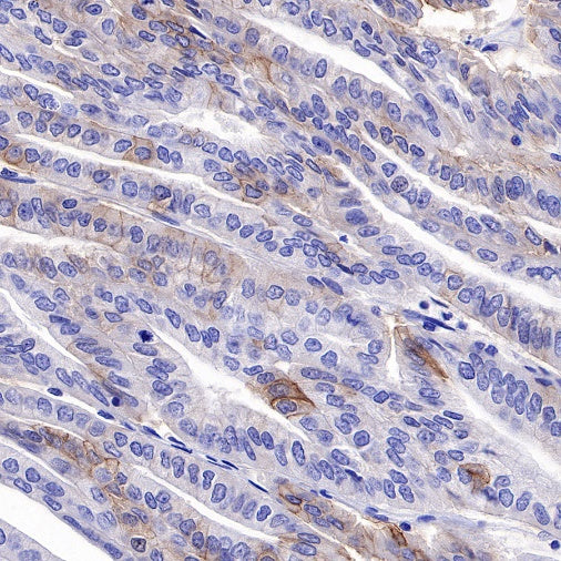 ROR1 Recombinant Rabbit mAb (SDT-R502)