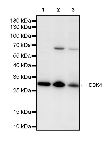 CDK4 Rabbit Polyclonal Antibody