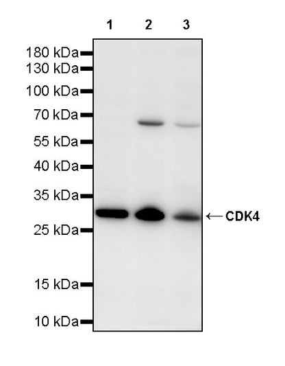CDK4 Rabbit Polyclonal Antibody