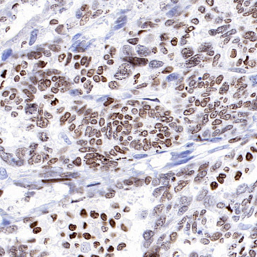 HMGA1 Recombinant Rabbit mAb (S-R332)