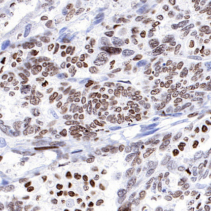 HMGA1 Recombinant Rabbit mAb (S-R332)