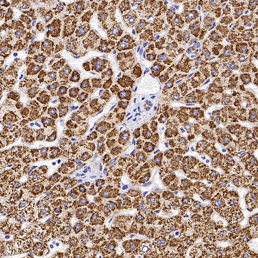 GLS1 Recombinant Rabbit mAb (S-2355-20)