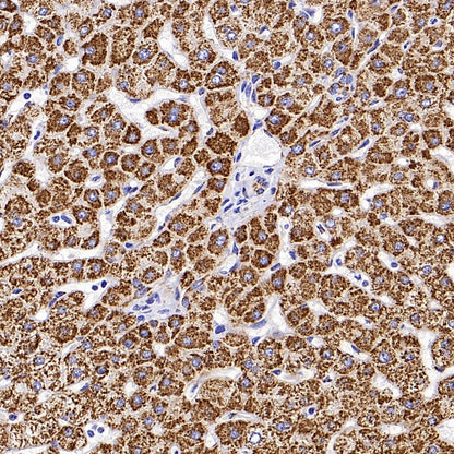 GLS1 Recombinant Rabbit mAb (S-2355-20)