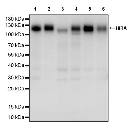 HIRA Recombinant Rabbit mAb (S-2928-13)