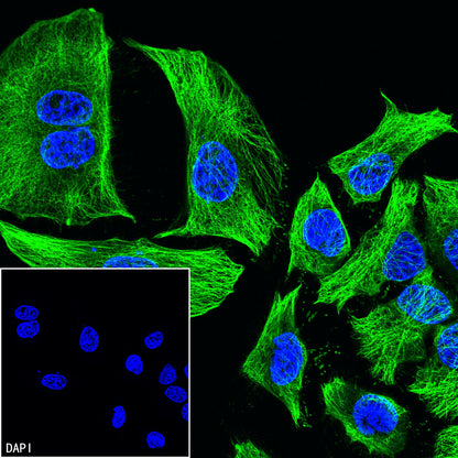 Beta III Tubulin Recombinant Rabbit mAb (S-5529)