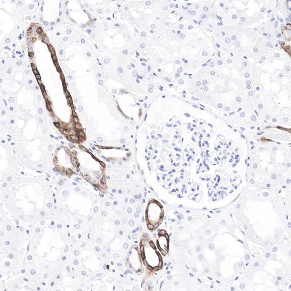 Cytokeratin 7 Recombinant Rabbit mAb (SDT-R028)
