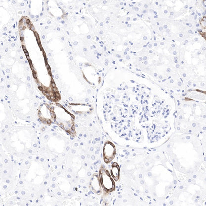 Cytokeratin 7 Recombinant Rabbit mAb (SDT-R028)