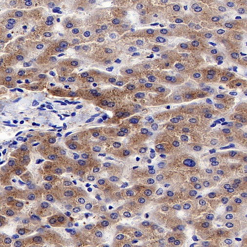 TRF Recombinant Rabbit mAb (S-613-85)
