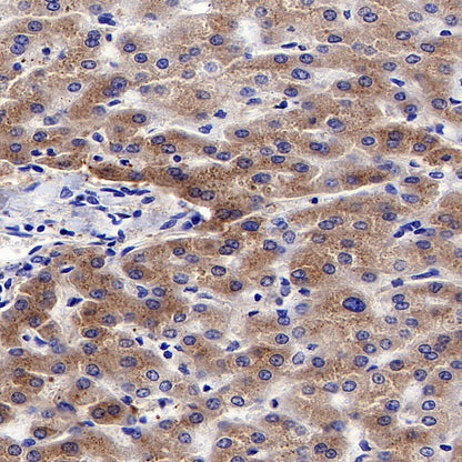 TRF Recombinant Rabbit mAb (S-613-85)