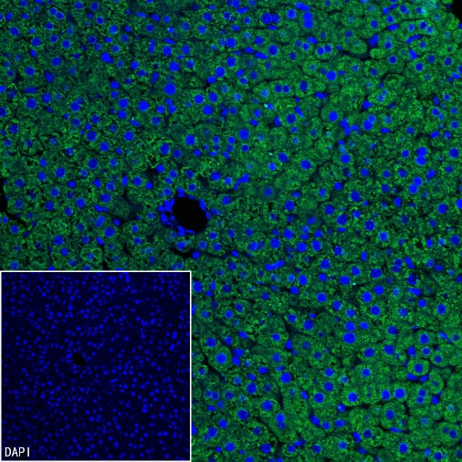 Coagulation factor V Recombinant Rabbit mAb (S-4489-58)