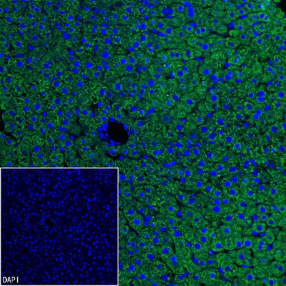 Coagulation factor V Recombinant Rabbit mAb (S-4489-58)