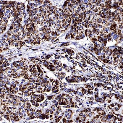 MTCO1 Recombinant Rabbit mAb (S-2205-28)