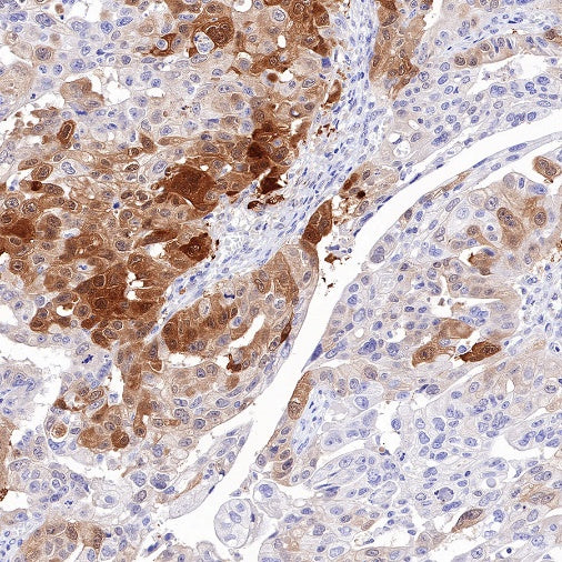 PGP9.5 Recombinant Rabbit mAb (SDT-665-37)