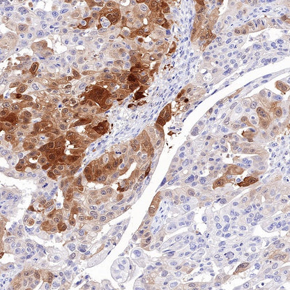 PGP9.5 Recombinant Rabbit mAb (SDT-665-37)