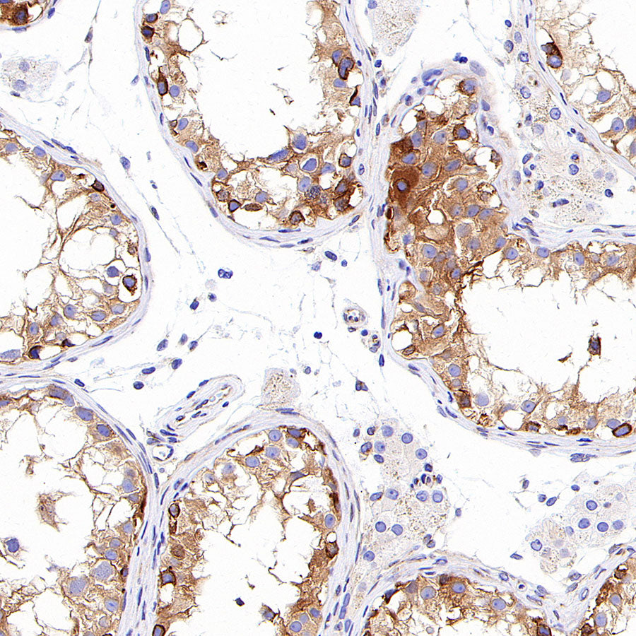 Alpha Tubulin Recombinant Mouse mAb (S-5704)
