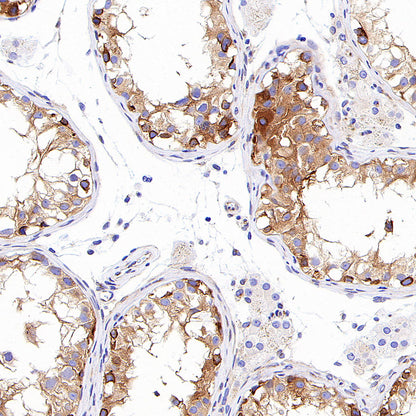 Alpha Tubulin Recombinant Mouse mAb (S-5704)