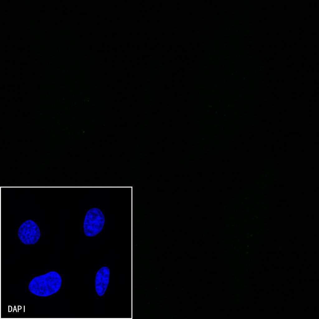 CD38 Mouse mAb (S-690-29)