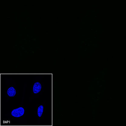 CD38 Mouse mAb (S-690-29)