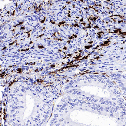 AOAH Recombinant Rabbit mAb (S-3713-10)