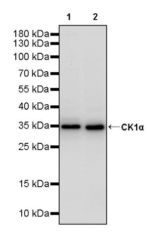 CK1α Recombinant Rabbit mAb (SDT-2884-60)