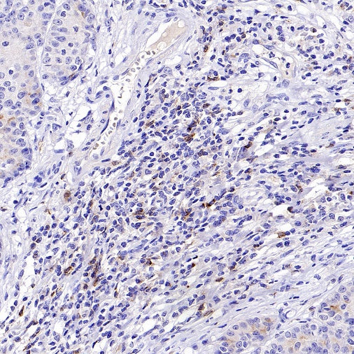 CD70 Recombinant Rabbit mAb (S-1725-277)