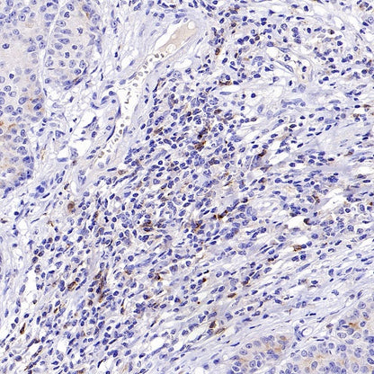 CD70 Recombinant Rabbit mAb (S-1725-277)
