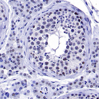 PES1 Recombinant Rat mAb (SDT-R197)