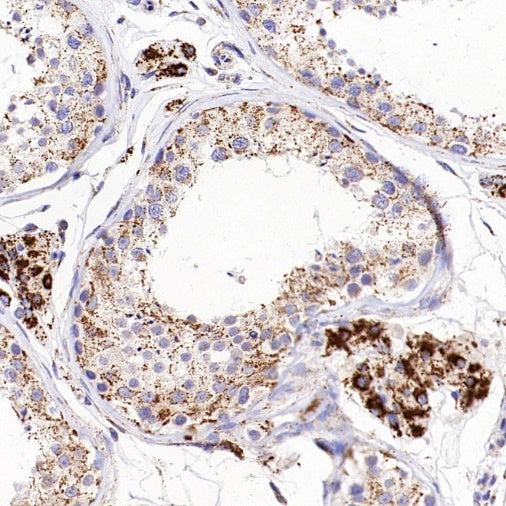 FDX1 Recombinant Rabbit mAb (S-3587-58)