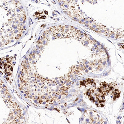 FDX1 Recombinant Rabbit mAb (S-3587-58)