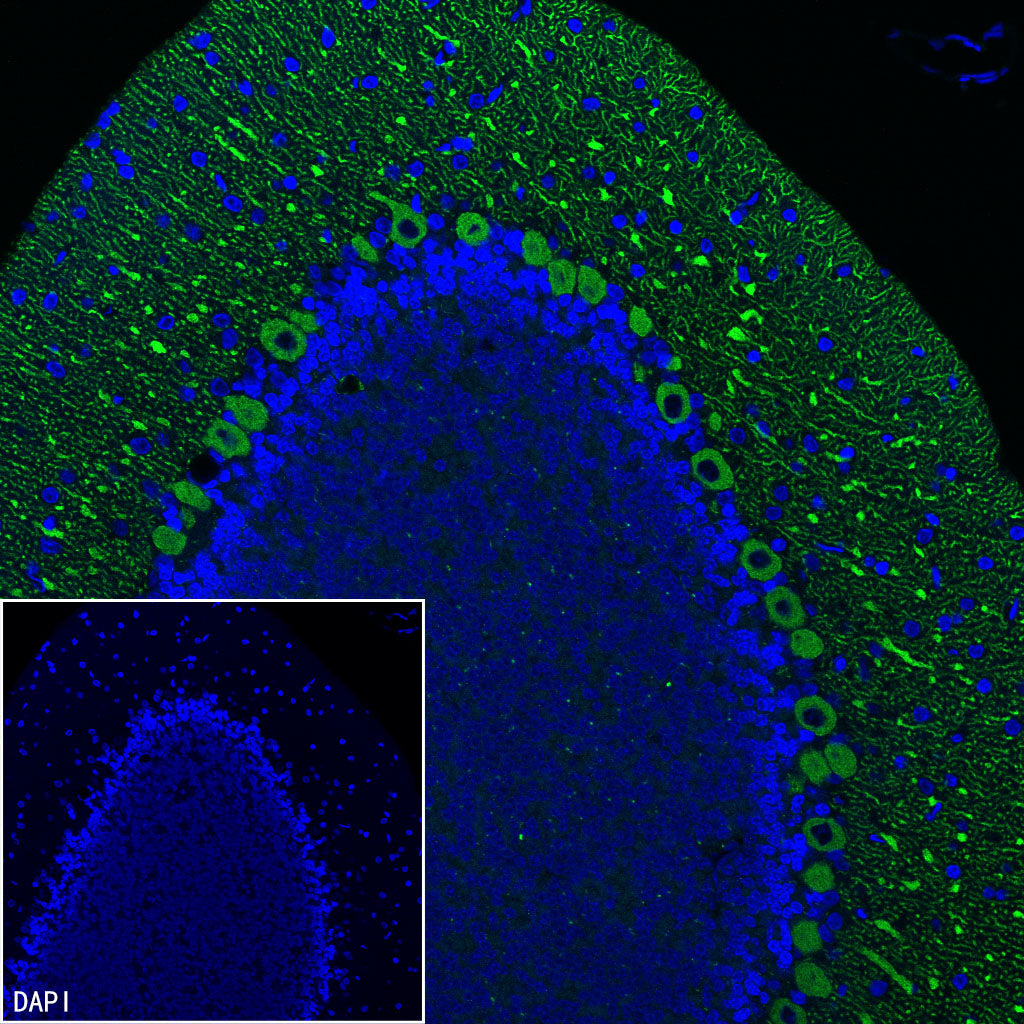 ITPR1 Recombinant Rabbit mAb (S-4530-5)