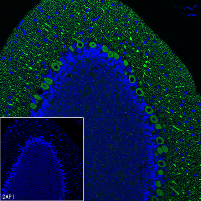 ITPR1 Recombinant Rabbit mAb (S-4530-5)