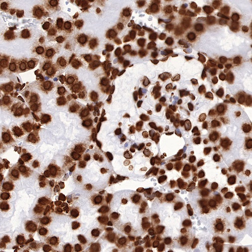 Histone H3 (tri methyl K27) Recombinant Rabbit mAb (SDT-431-118)