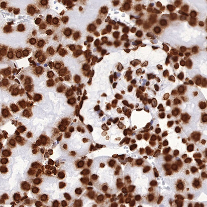 Histone H3 (tri methyl K27) Recombinant Rabbit mAb (SDT-431-118)