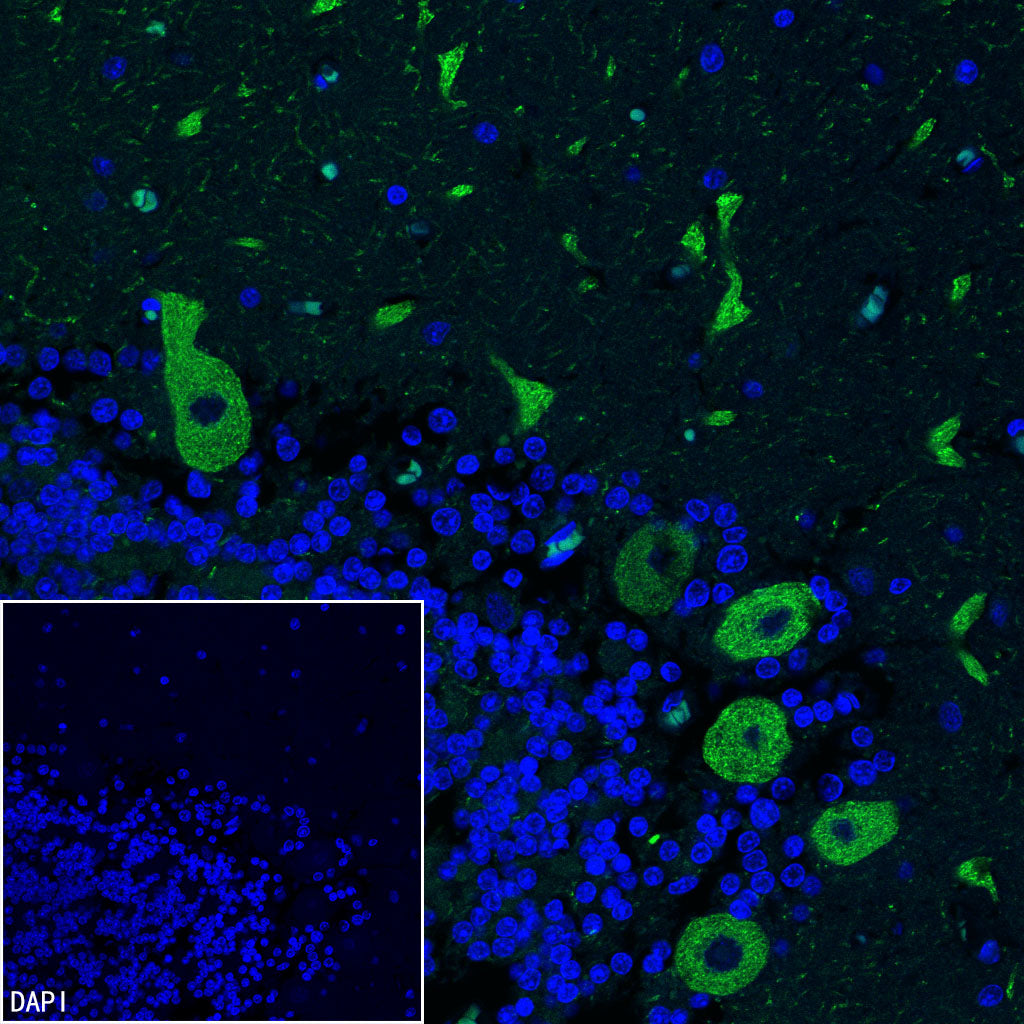 ITPR1 Recombinant Rabbit mAb (S-4530-5)