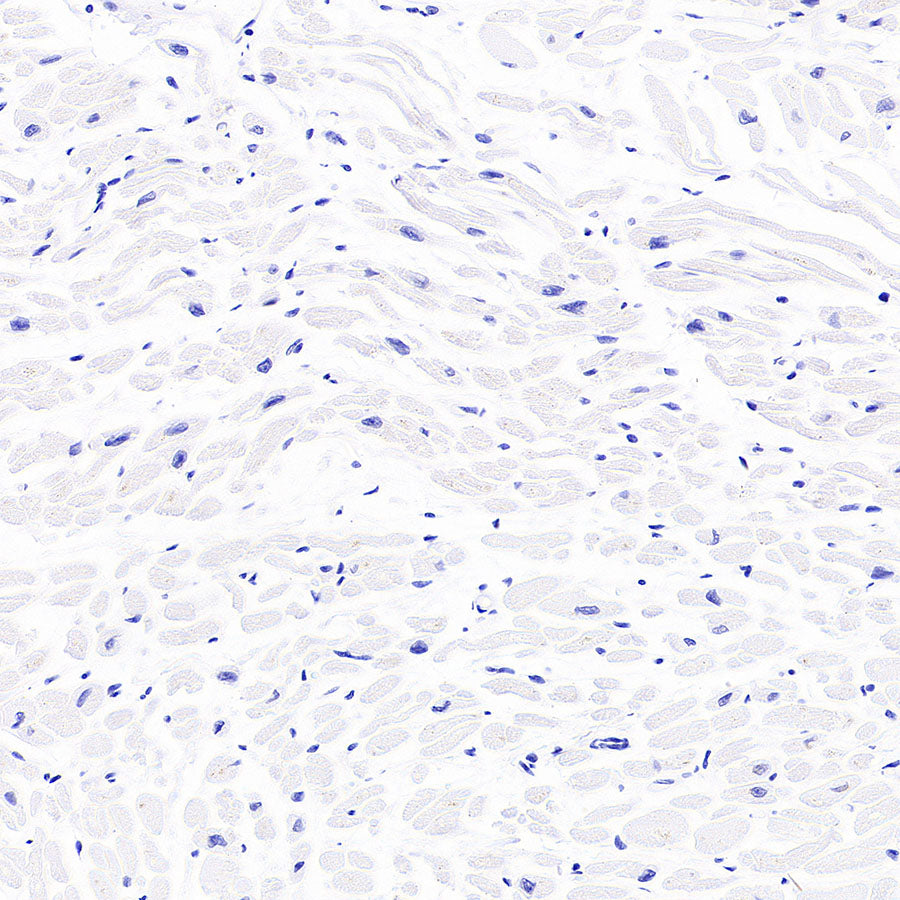 Stat4 Recombinant Rabbit mAb (S-4916-70)