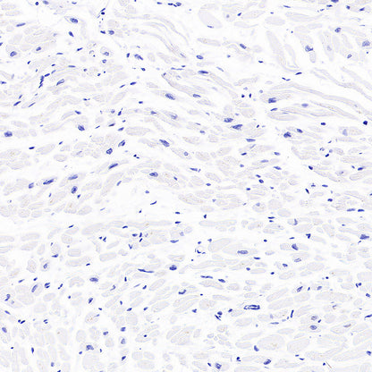 Stat4 Recombinant Rabbit mAb (S-4916-70)