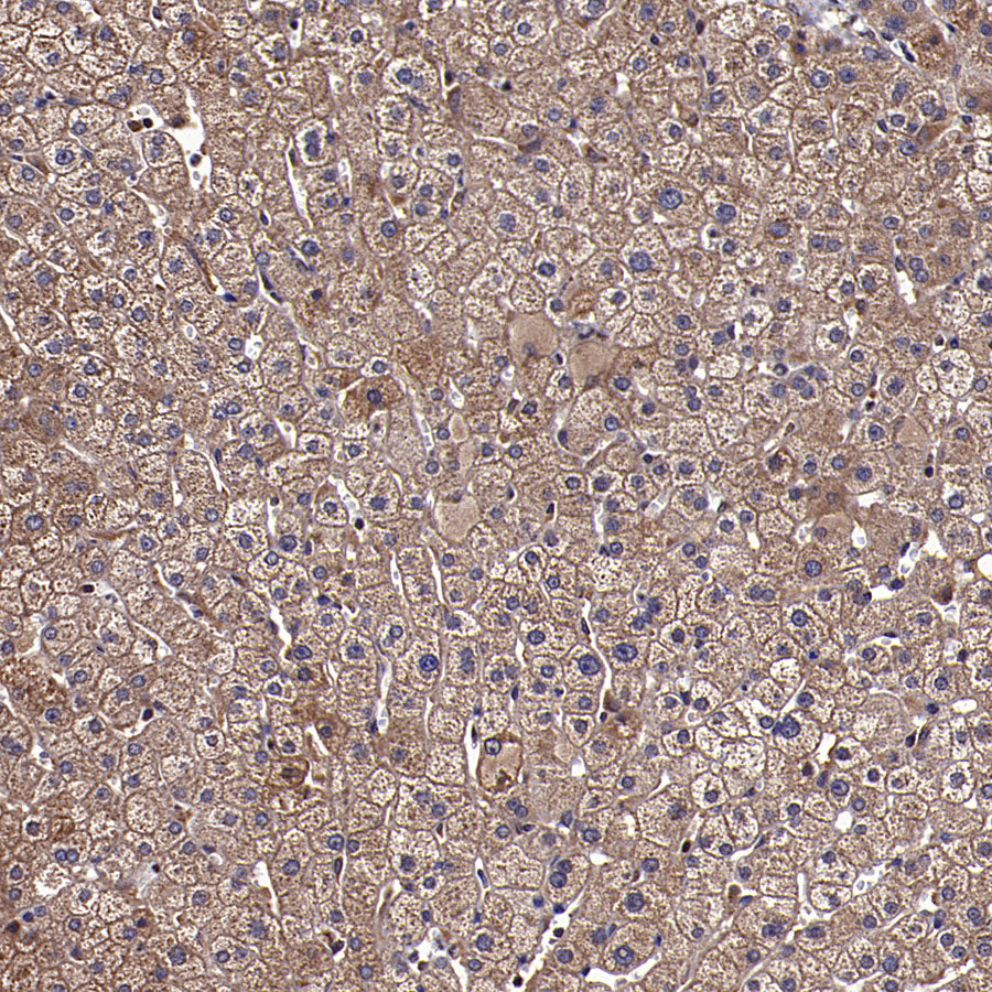 APOL2 Recombinant Rabbit mAb (S-3627-115)