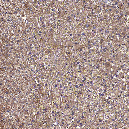 APOL2 Recombinant Rabbit mAb (S-3627-115)