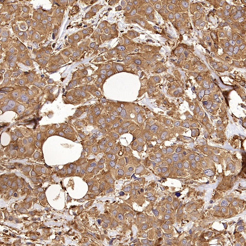 PFKL+PFKM Recombinant Rabbit mAb (S-1302-31)