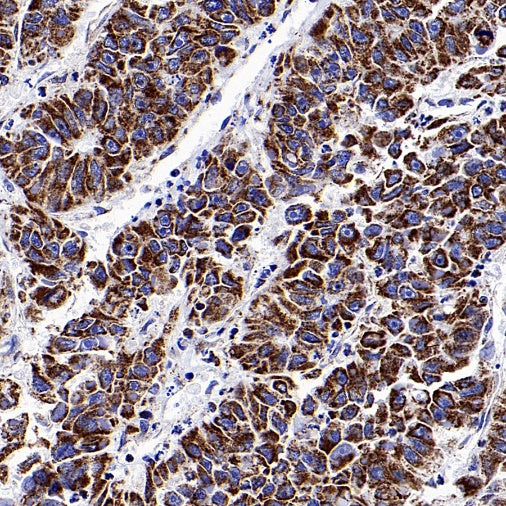 Parkin Rabbit Polyclonal Antibody