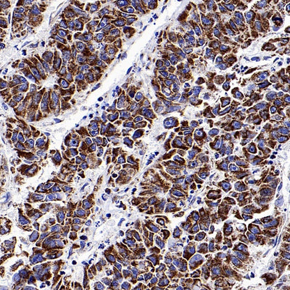 Parkin Rabbit Polyclonal Antibody