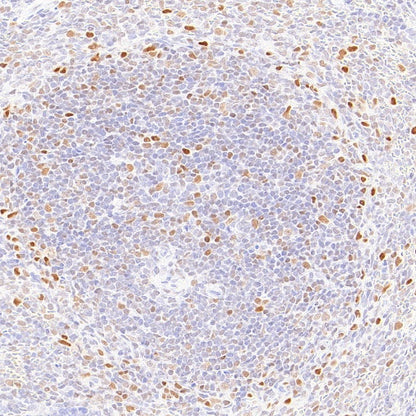FOXP4 Recombinant Rabbit mAb (S-6198)