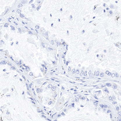 Claudin-1 Recombinant Rabbit mAb,PBS Only (SDT-R024)