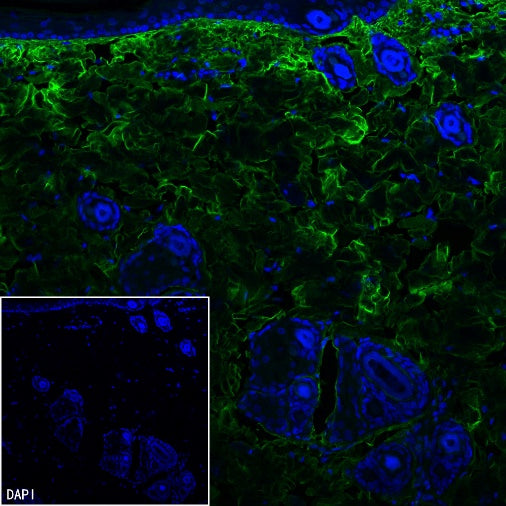 COL1A1 Recombinant Rabbit mAb (S-2975-9)
