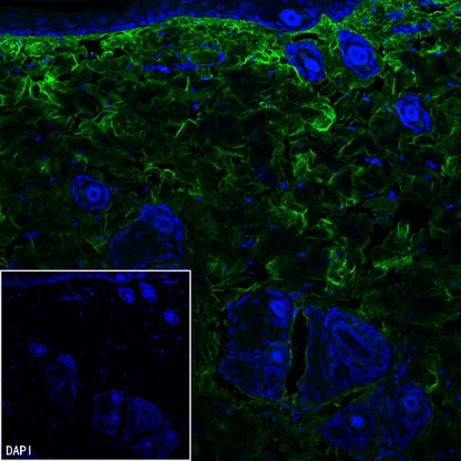 COL1A1 Recombinant Rabbit mAb (S-2975-9)