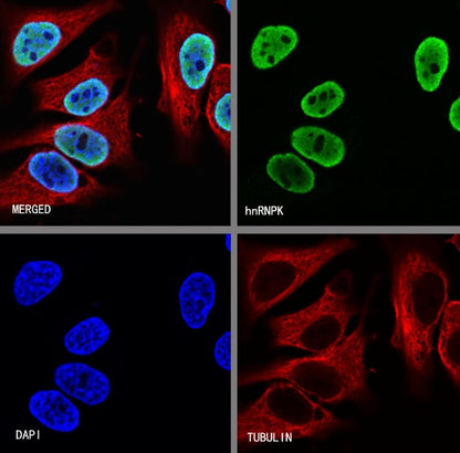 hnRNPK Recombinant Rabbit mAb (S-1645-45)