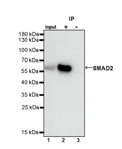 SMAD2 Rabbit Polyclonal Antibody
